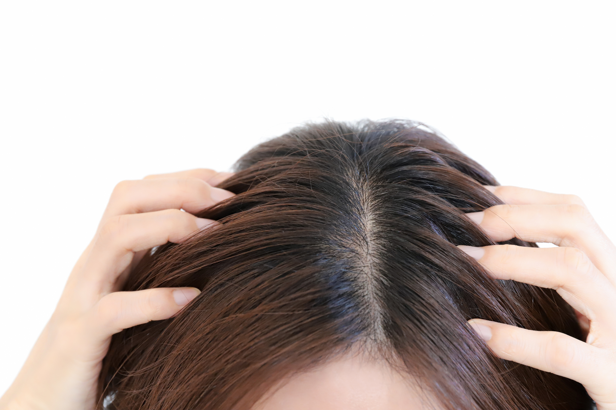 更年期女性の薄毛対策：冬の頭皮の血行不良を改善する6つの対策を解説