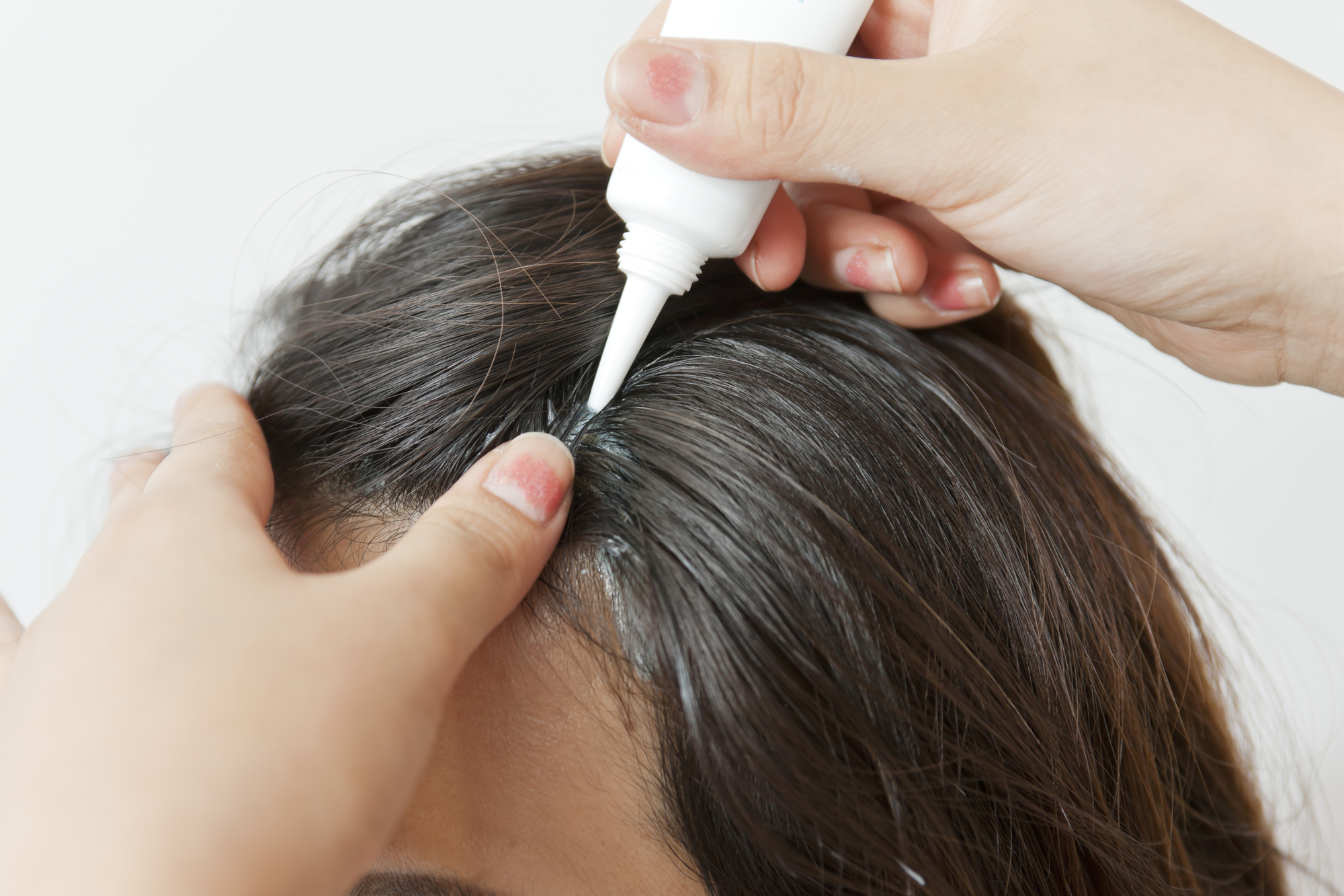 効果を最大限に引き出す！育毛剤の正しい使い方